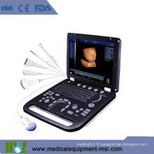 MSLCU18K Doppler couleur Échographie portable pour la grossesse